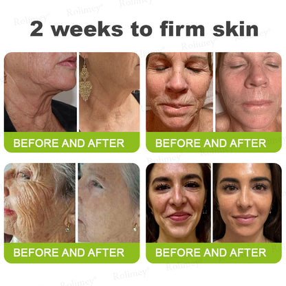 ✅Rolimey® Botox & Vita-A Retinol Shot Wrinkle-Lift Tightening cream - Last Day Promotion 70% OFF