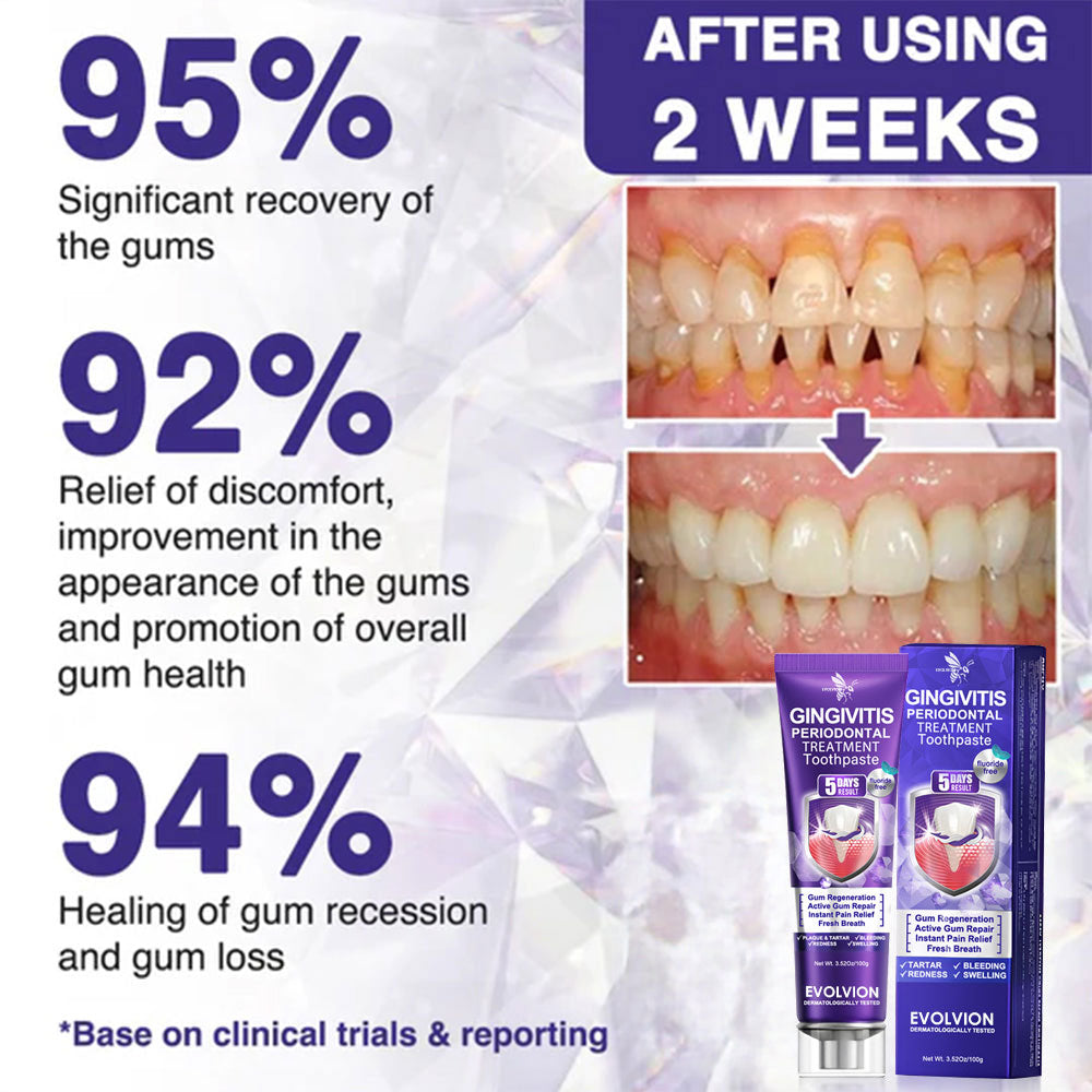 🇺🇸❤️🦷Evolvion® Bee Venom Gingivitis & Periodontitis Treatment Toothpaste🎁