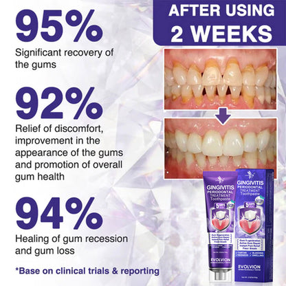 🇺🇸❤️🦷Evolvion® Bee Venom Gingivitis & Periodontitis Treatment Toothpaste🎁