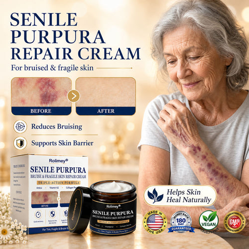 💥 2026 Best-Selling Skin Care | Rolimey® Bruise Care Cream | Advanced Care for Fragile, Aging & Bruise-Prone Skin