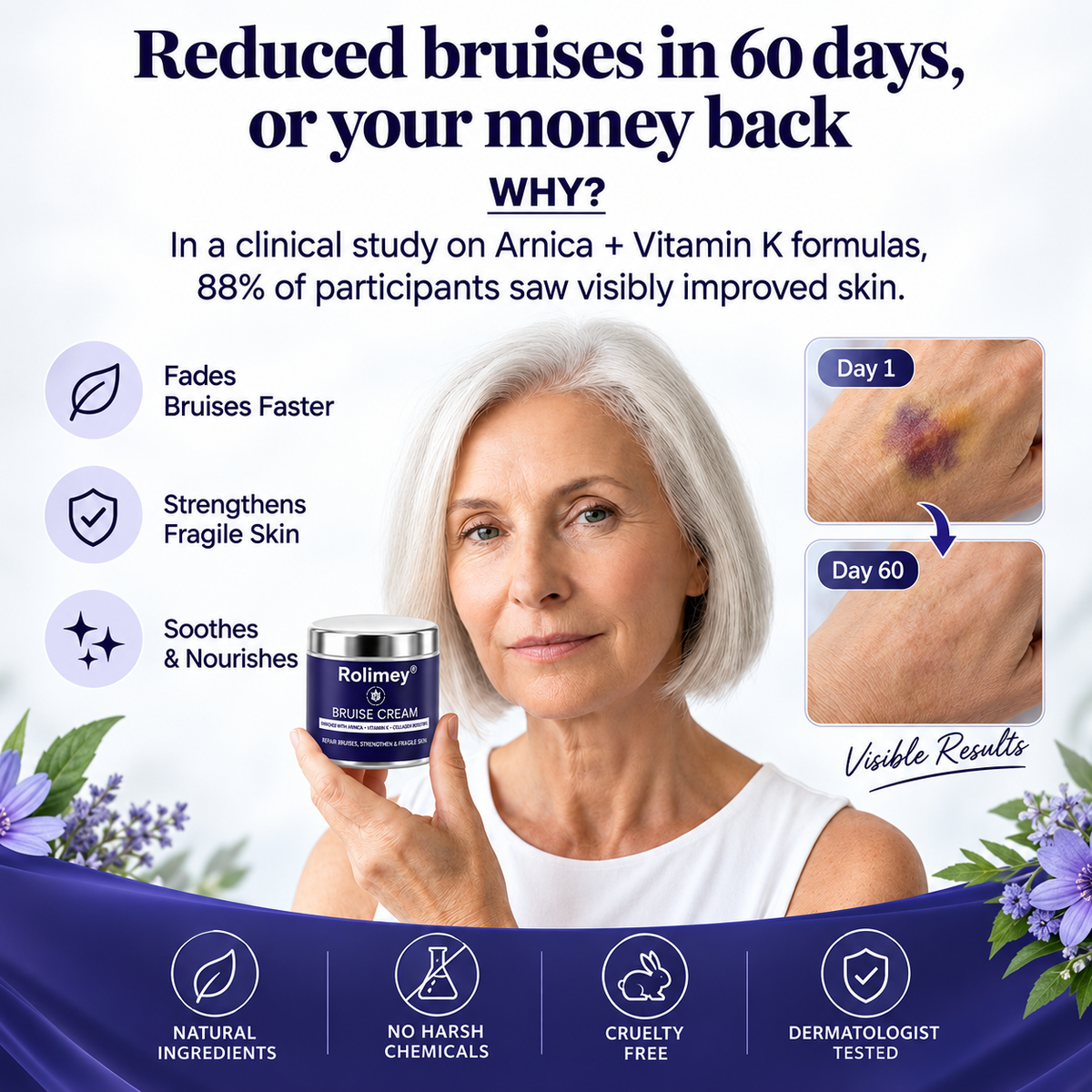✨👩‍⚕️Rolimey® BruiseRepair & Skin-Strengthening Cream-Advanced daily care forbruise-prone skin