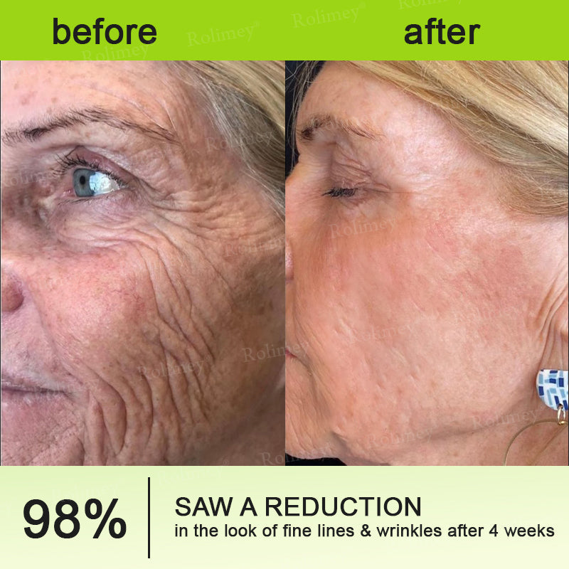 🔥Rolimey® Vita-A Retinal Shot Tightening Dual Cream - Last Day Promotion 70% OFF