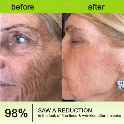 🔥Rolimey® Vita-A Retinal Shot Tightening Dual Cream - Last Day Promotion 70% OFF