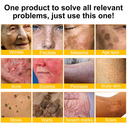 🌙2026 New Rolimey® Bee Venom Advanced Skin Rescue Cream | Botox-Inspired Firming & Smoothing Care for All Skin Types
