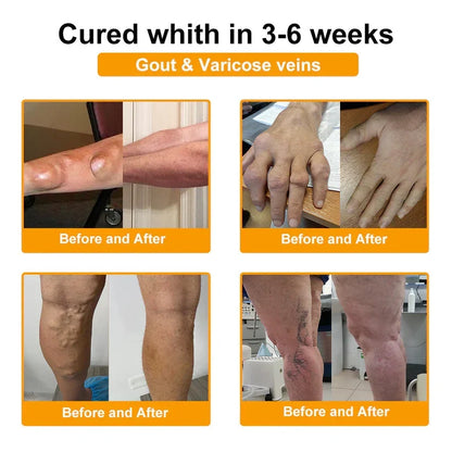 🎁🎁Official Shop:Rolimey® Bee Venom Pain Relief Bone Healing Cream 👨‍⚕️(Reduction of joint swelling, pain, stiffness, redness, heat, muscle soreness and joint fatigue)