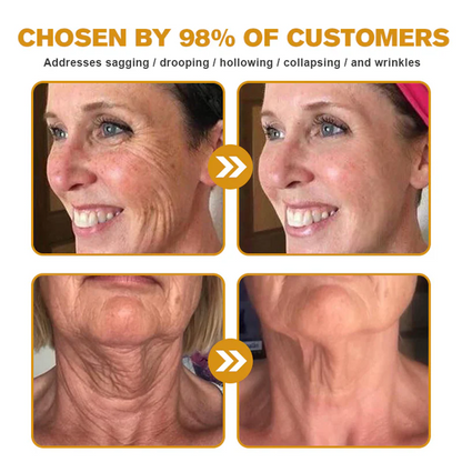 🌟Rolimey® Bee venom Pro Comprehensive Cream —Tightening for Skin Types