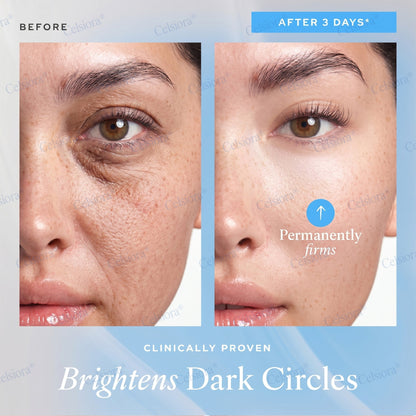 🎁✨US HOT SALE Celsiora® Botox & PDRNAnti-Wrinkle ShotLift & Firming Cream