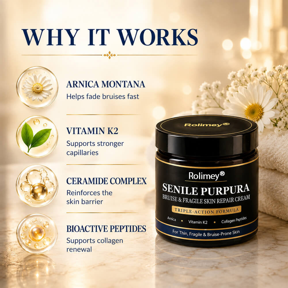 💥 2026 Best-Selling Skin Care | Rolimey® Bruise Care Cream | Advanced Care for Fragile, Aging & Bruise-Prone Skin