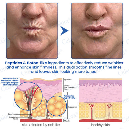 🎁✨US HOT SALE Celsiora® Botox & PDRNAnti-Wrinkle ShotLift & Firming Cream