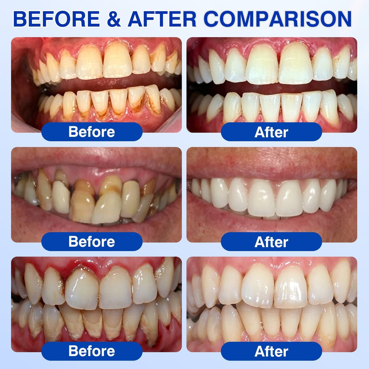🇦🇺🛡️🦷Evolvion® GumRevive Periodontal Repair Gel🛡️✨
