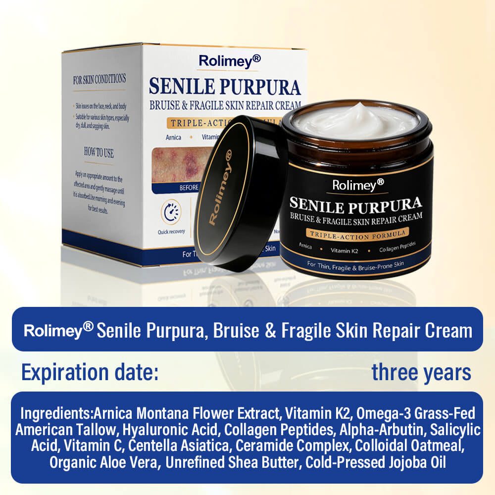 💥 2026 Best-Selling Skin Care | Rolimey® Bruise Care Cream | Advanced Care for Fragile, Aging & Bruise-Prone Skin