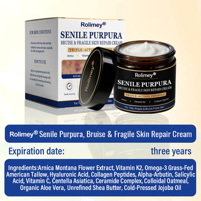 💥 2026 Best-Selling Skin Care | Rolimey® Bruise Care Cream | Advanced Care for Fragile, Aging & Bruise-Prone Skin