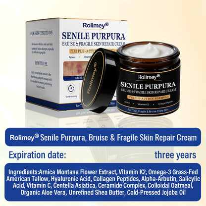 🎁30%off Rolimey® BruiseRepair & Skin-Strengthening Cream🎁