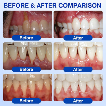 🇦🇺🛡️🦷Evolvion® GumRevive Periodontal Repair Gel🛡️✨