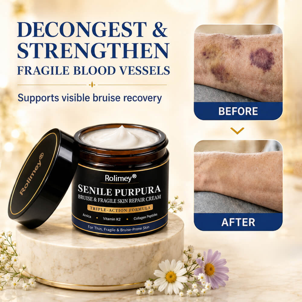 💥 2026 Best-Selling Skin Care | Rolimey® Bruise Care Cream | Advanced Care for Fragile, Aging & Bruise-Prone Skin