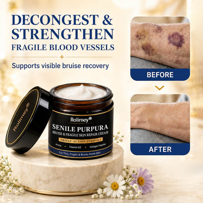 🎁30%off Rolimey® BruiseRepair & Skin-Strengthening Cream🎁