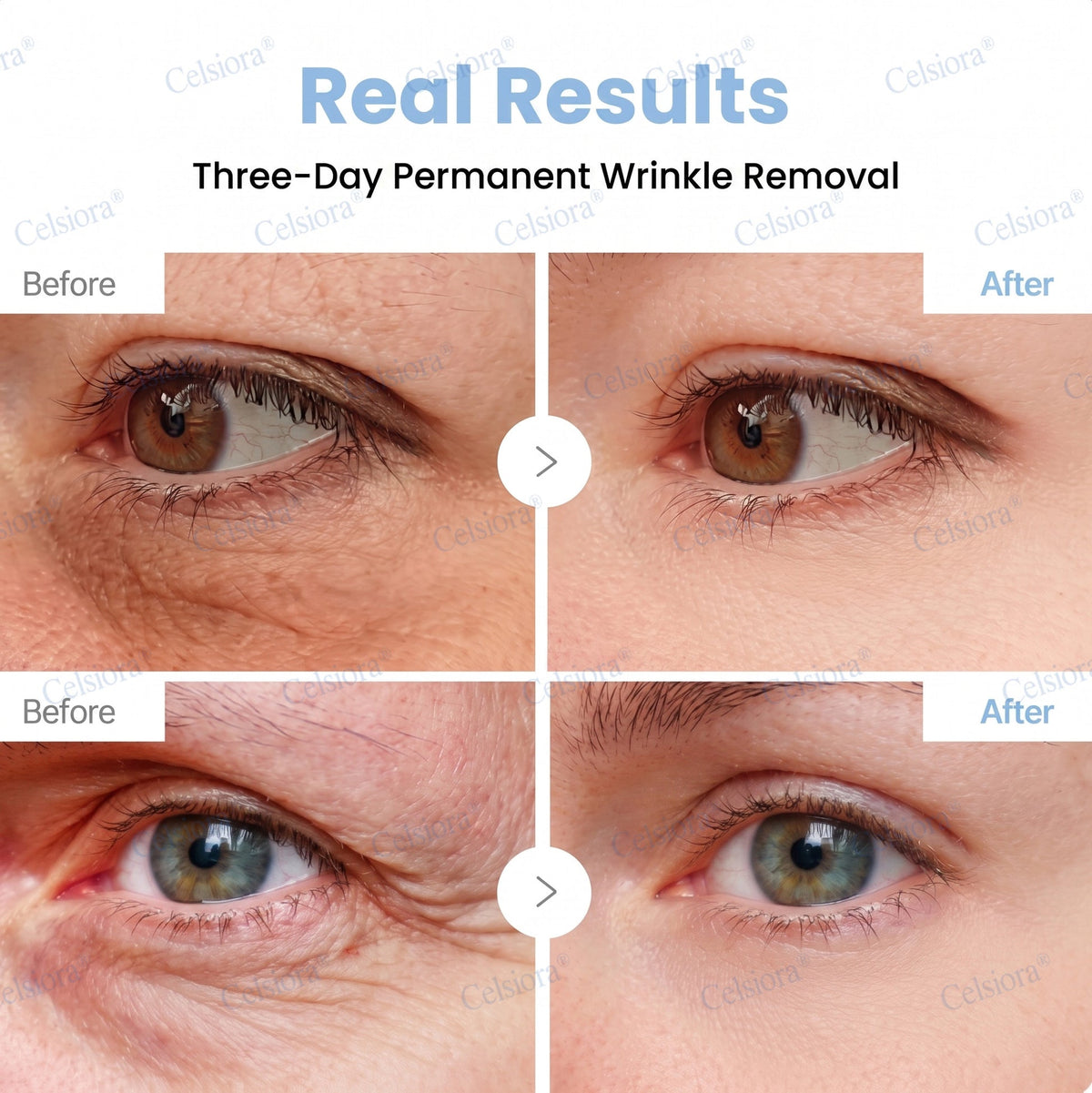 🎁✨US HOT SALE Celsiora® Botox & PDRNAnti-Wrinkle ShotLift & Firming Cream