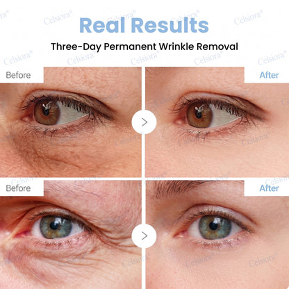 🎁✨US HOT SALE Celsiora® Botox & PDRNAnti-Wrinkle ShotLift & Firming Cream