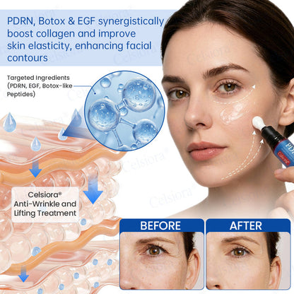 🎁✨US HOT SALE Celsiora® Botox & PDRNAnti-Wrinkle ShotLift & Firming Cream