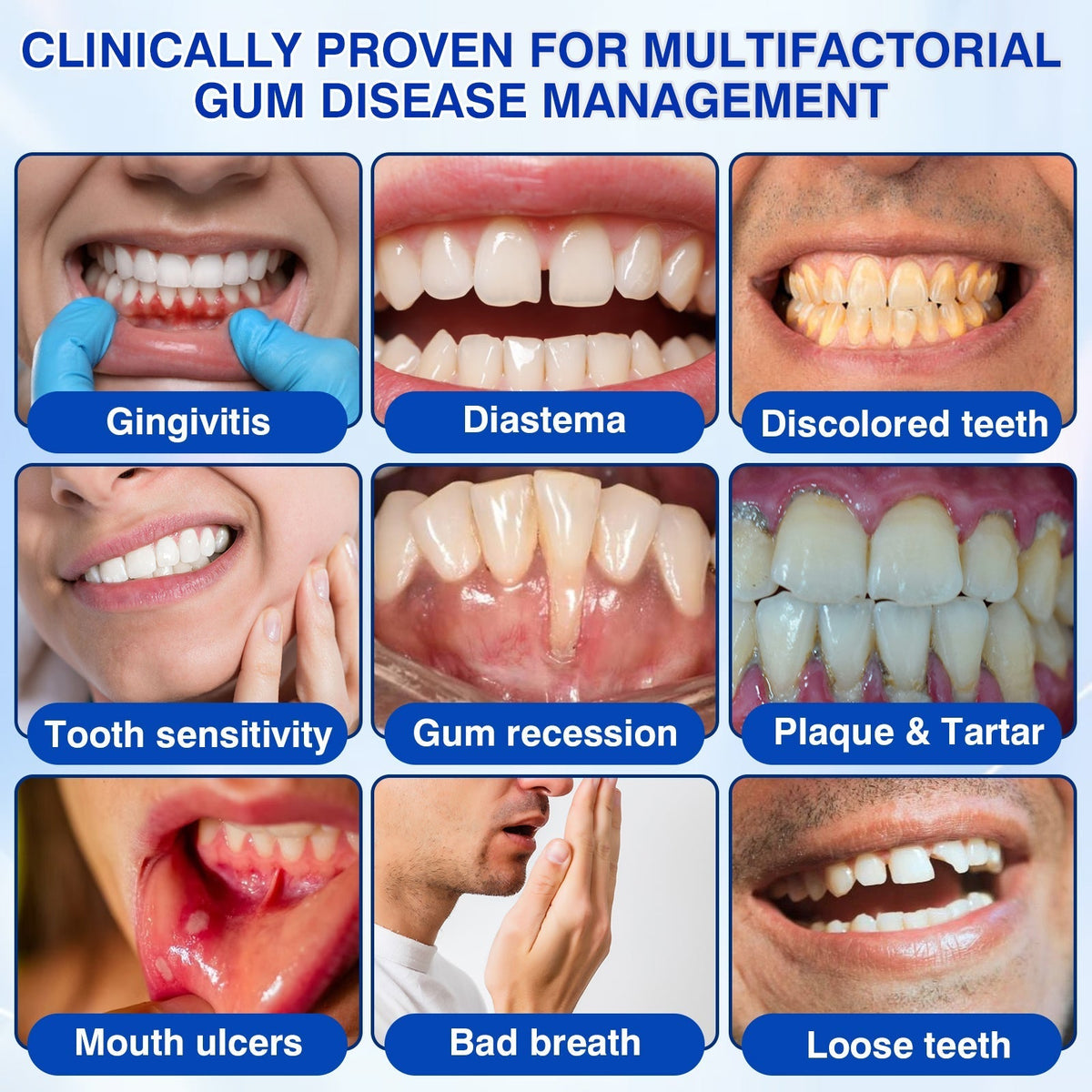 🇦🇺🛡️🦷Evolvion® GumRevive Periodontal Repair Gel🛡️✨