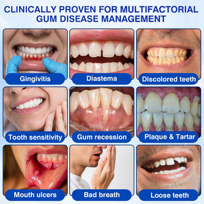 🎁🦷30% OFF for GumRevive Periodontal Repair Gel🛡️