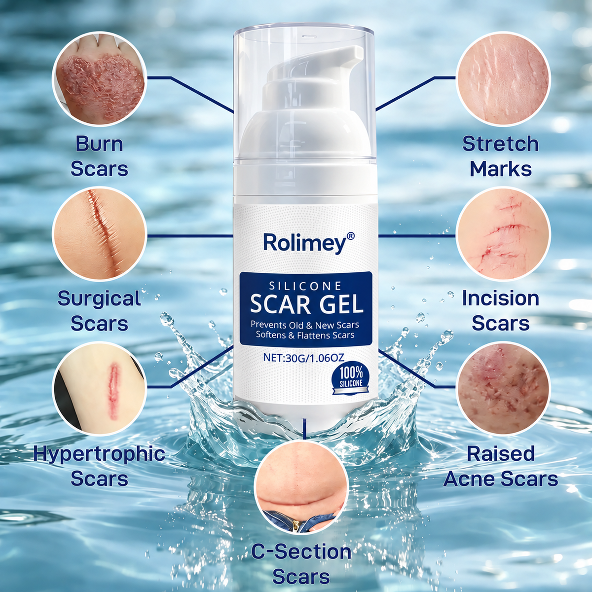 Rolimey® SILICONE SCAR GEL for Healed Skin – Advanced Care for Surgical, C-Section, Acne & Burn Scars