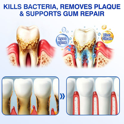 🎁🦷30% OFF for GumRevive Periodontal Repair Gel🛡️