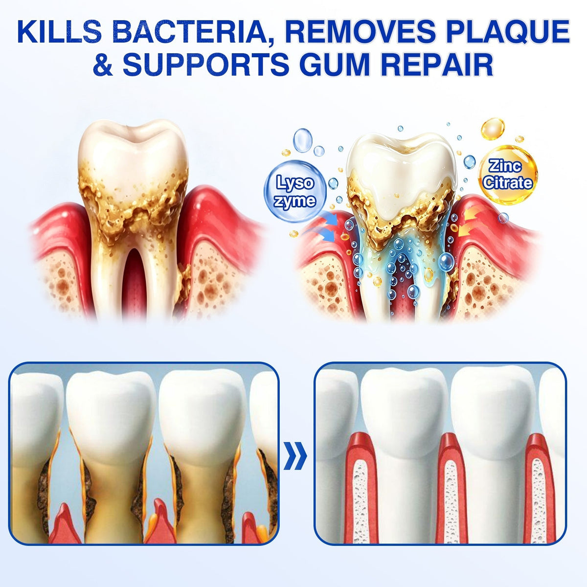 🇦🇺🛡️🦷Evolvion® GumRevive Periodontal Repair Gel🛡️✨
