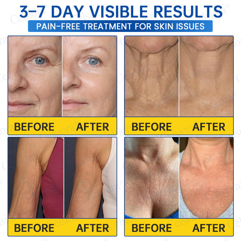 🎁✨US HOT SALE Celsiora® Botox & PDRNAnti-Wrinkle ShotLift & Firming Cream
