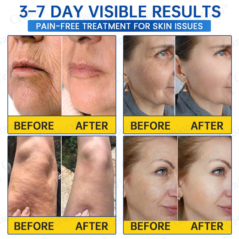 🎁✨US HOT SALE Celsiora® Botox & PDRNAnti-Wrinkle ShotLift & Firming Cream