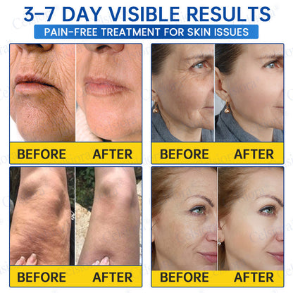 🎁✨US HOT SALE Celsiora® Botox & PDRNAnti-Wrinkle ShotLift & Firming Cream