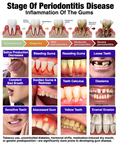 🇺🇸❤️🦷Evolvion® Bee Venom Gingivitis & Periodontitis Treatment Toothpaste🎁
