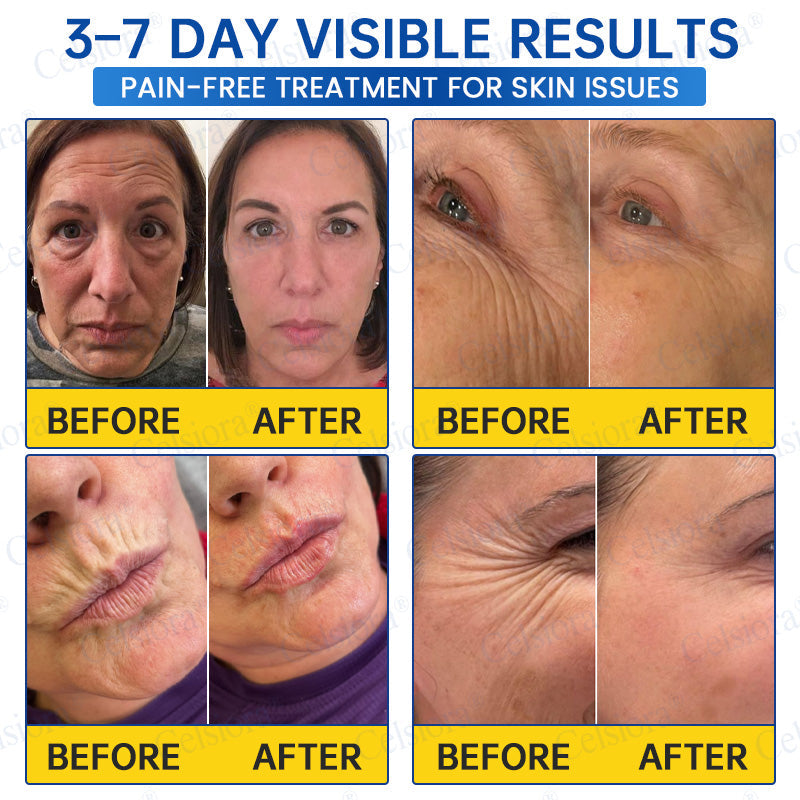 🎁✨US HOT SALE Celsiora® Botox & PDRNAnti-Wrinkle ShotLift & Firming Cream