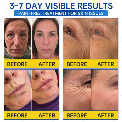 🎁✨US HOT SALE Celsiora® Botox & PDRNAnti-Wrinkle ShotLift & Firming Cream