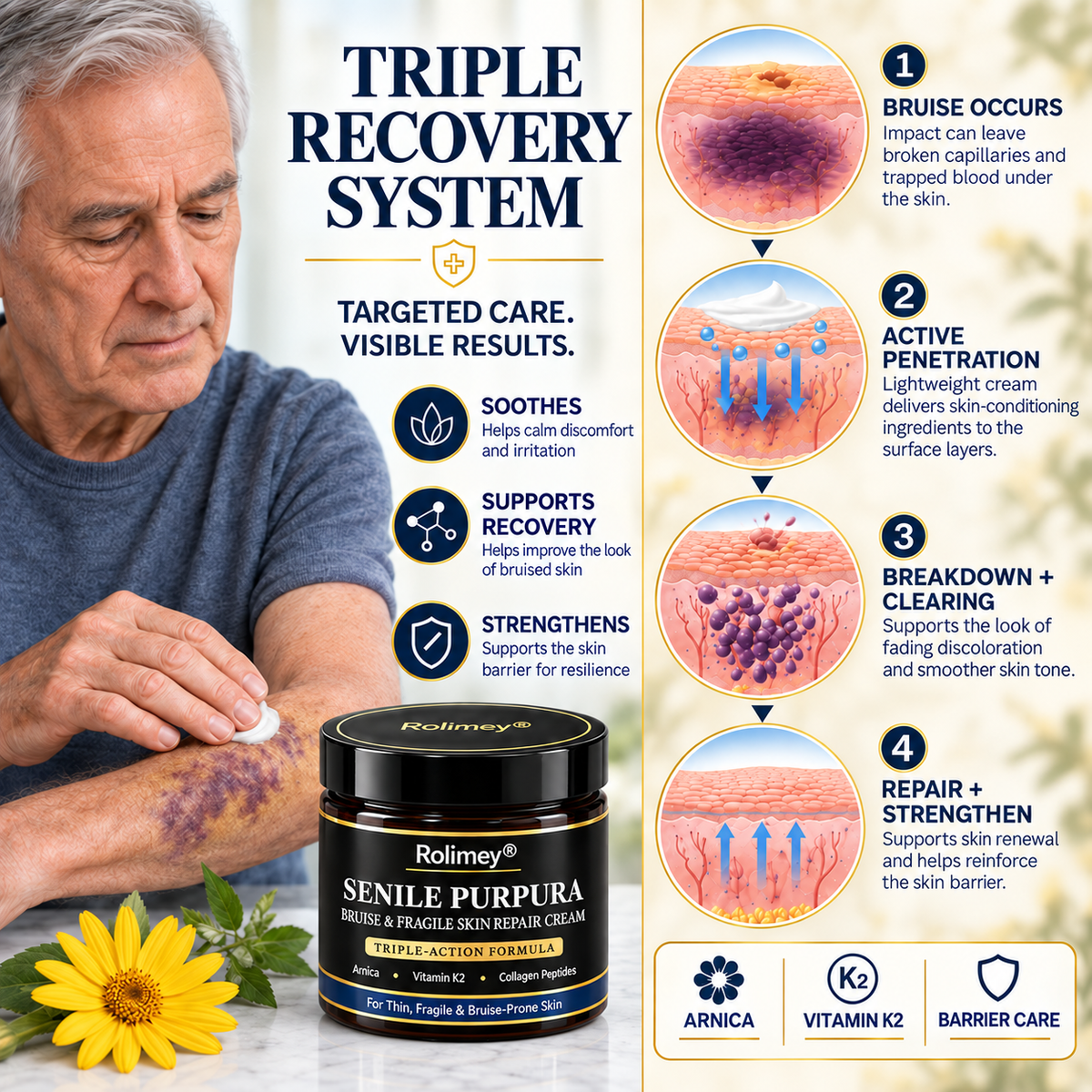 🎁30%off Rolimey® BruiseRepair & Skin-Strengthening Cream🎁