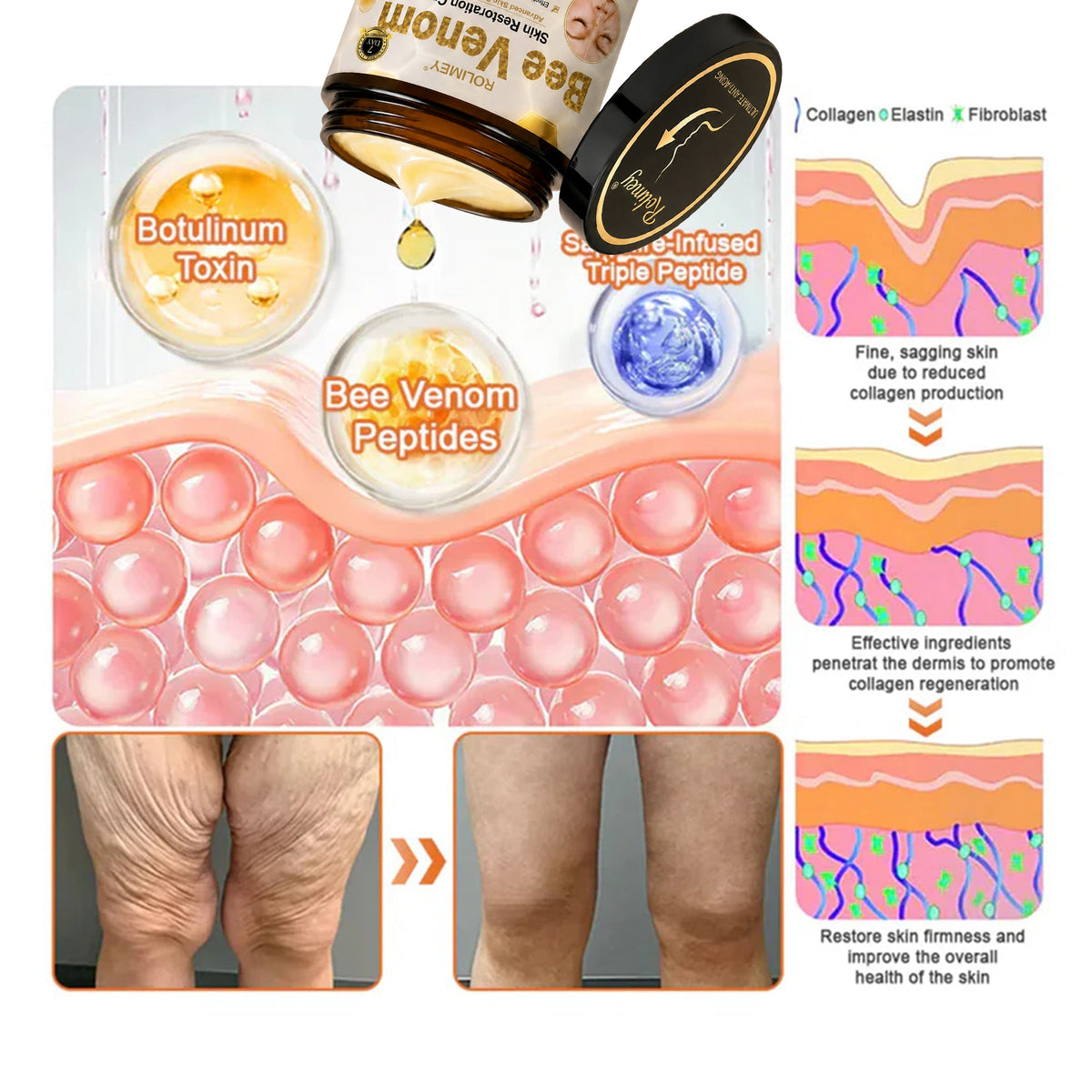 🌟Rolimey® Bee venom Pro Comprehensive Cream —Tightening for Skin Types