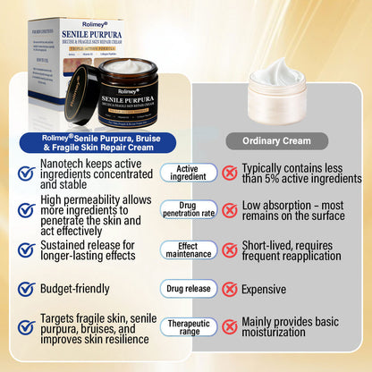 💥 2026 Best-Selling Skin Care | Rolimey® Bruise Care Cream | Advanced Care for Fragile, Aging & Bruise-Prone Skin