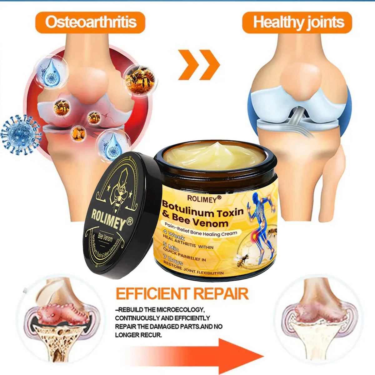 🎁🎁Official Shop:Rolimey® Bee Venom Pain Relief Bone Healing Cream 👨‍⚕️(Reduction of joint swelling, pain, stiffness, redness, heat, muscle soreness and joint fatigue)