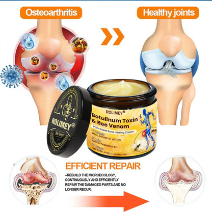 🎁🎁Official Shop:Rolimey® Bee Venom Pain Relief Bone Healing Cream 👨‍⚕️(Reduction of joint swelling, pain, stiffness, redness, heat, muscle soreness and joint fatigue)