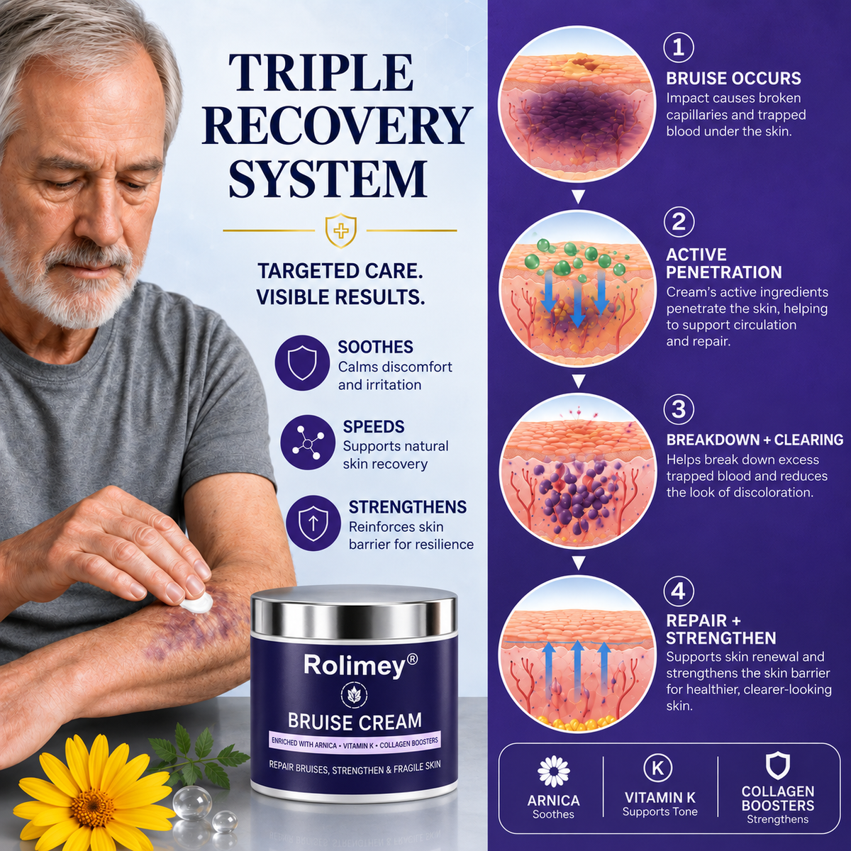 ✨👩‍⚕️Rolimey® BruiseRepair & Skin-Strengthening Cream-Advanced daily care forbruise-prone skin