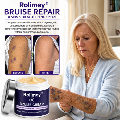 ✨👩‍⚕️Rolimey® BruiseRepair & Skin-Strengthening Cream-Advanced daily care forbruise-prone skin