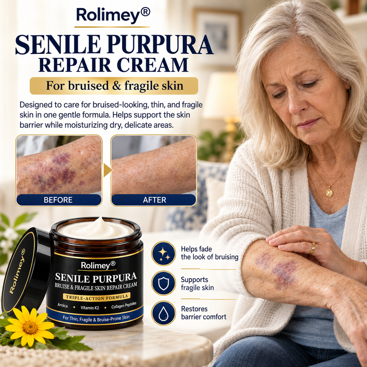 🎁30%off Rolimey® BruiseRepair & Skin-Strengthening Cream🎁