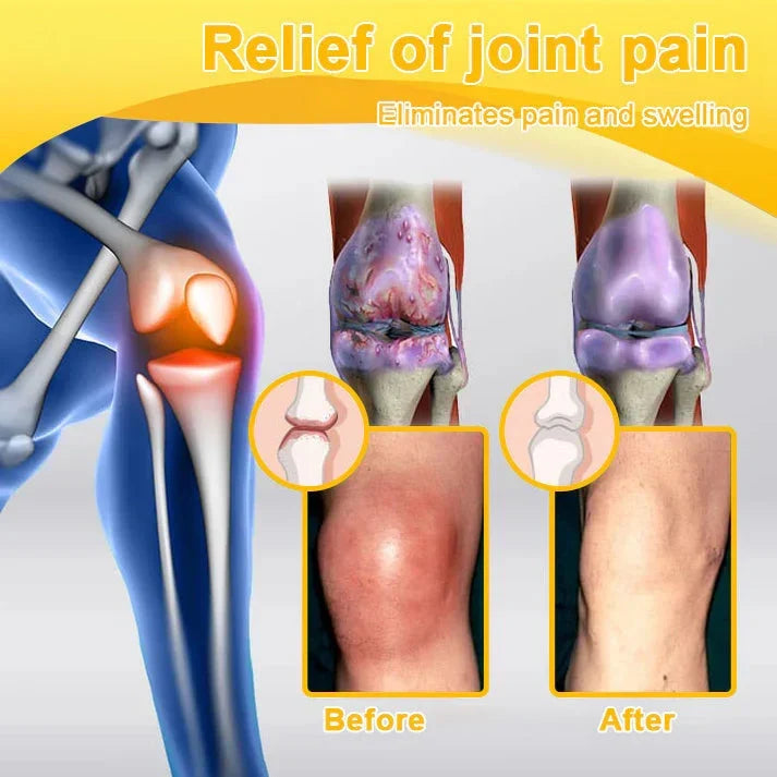 🎁🎁Official Shop:Rolimey® Bee Venom Pain Relief Bone Healing Cream 👨‍⚕️(Reduction of joint swelling, pain, stiffness, redness, heat, muscle soreness and joint fatigue)