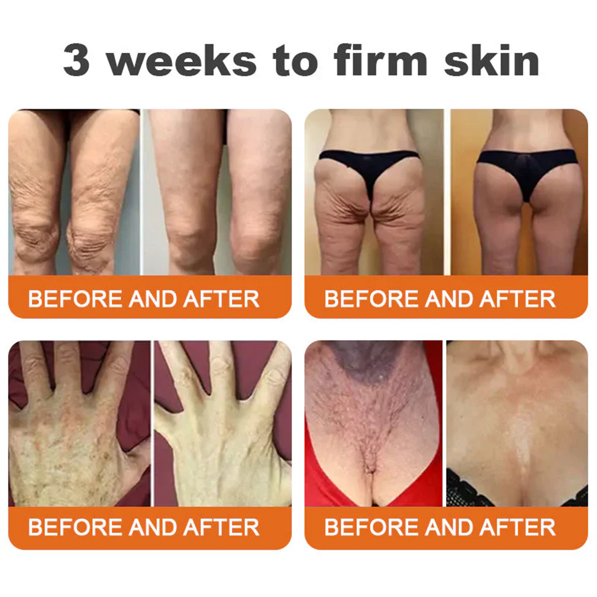 🌟Rolimey® Bee venom Pro Comprehensive Cream —Tightening for Skin Types