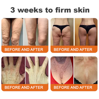 🌟Rolimey® Bee venom Pro Comprehensive Cream —Tightening for Skin Types