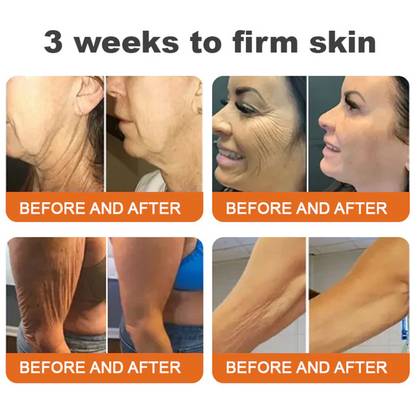 🌟Rolimey® Bee venom Pro Comprehensive Cream —Tightening for Skin Types