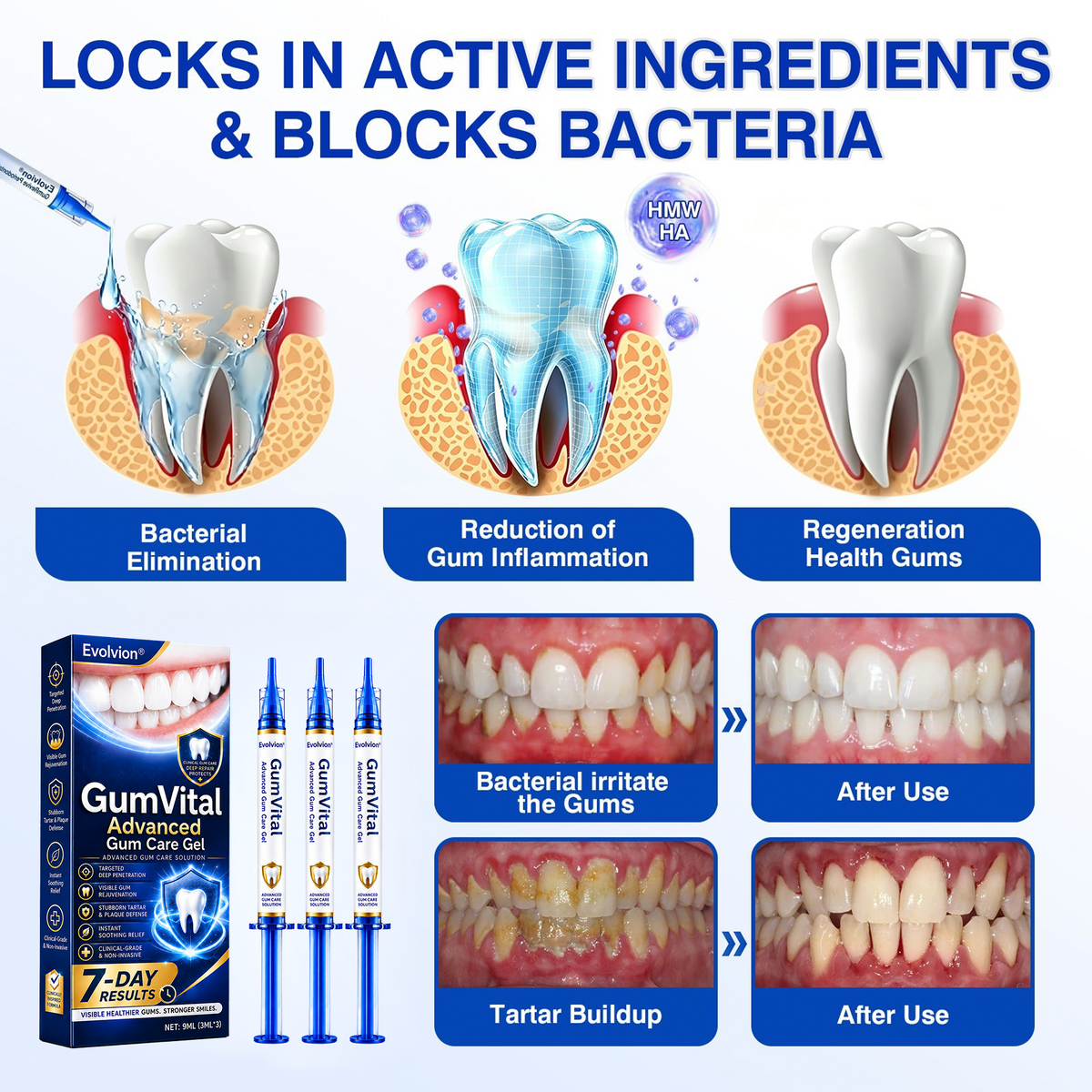 🇦🇺🛡️🦷Evolvion® GumRevive Periodontal Repair Gel🛡️✨