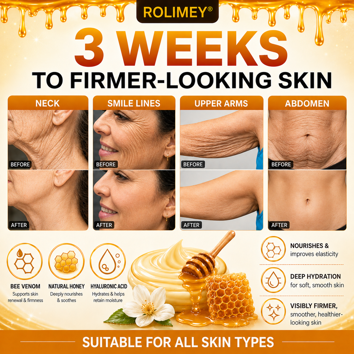 🌙2026 New Rolimey® Bee Venom Advanced Skin Rescue Cream | Botox-Inspired Firming & Smoothing Care for All Skin Types