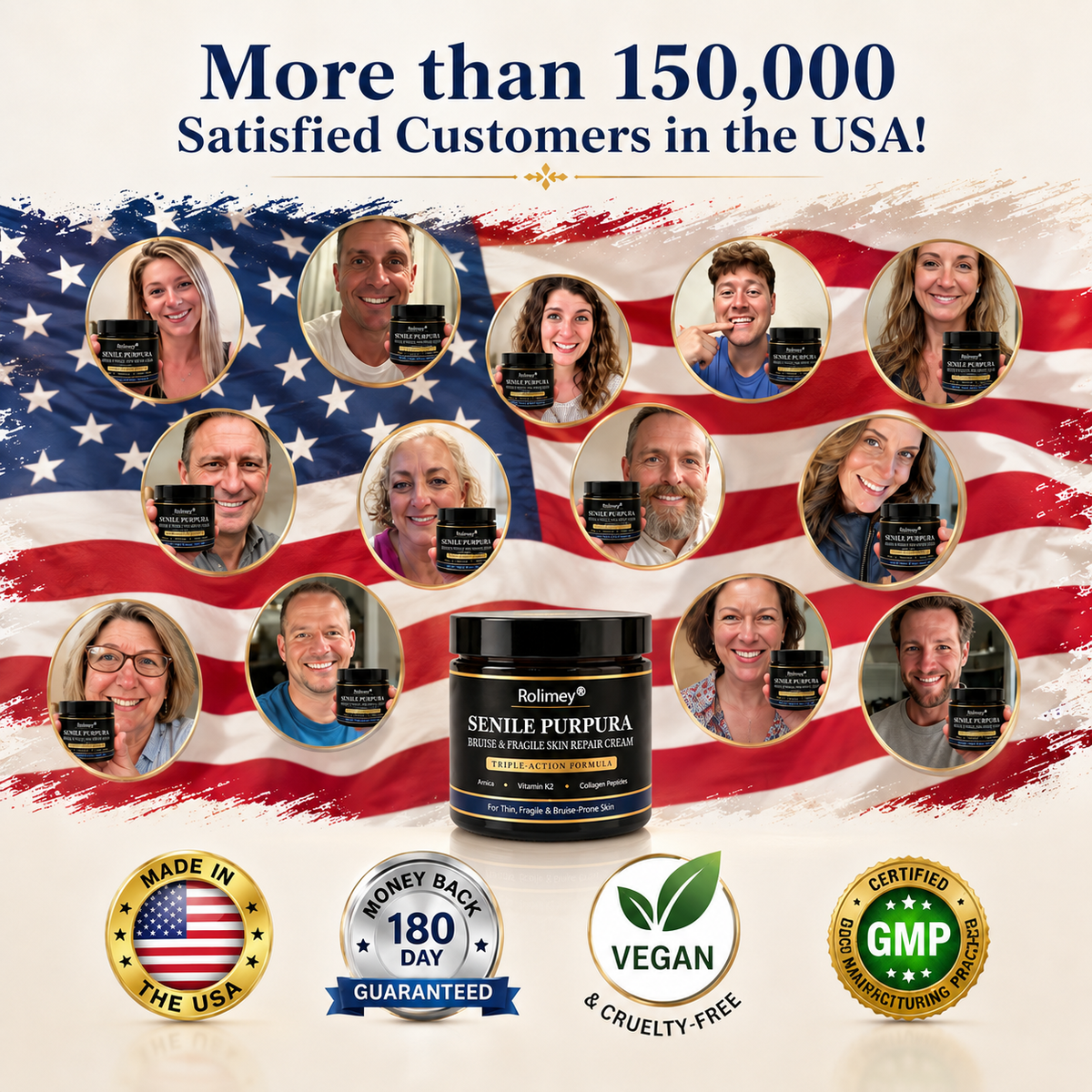 💥 2026 Best-Selling Skin Care | Rolimey® Bruise Care Cream | Advanced Care for Fragile, Aging & Bruise-Prone Skin