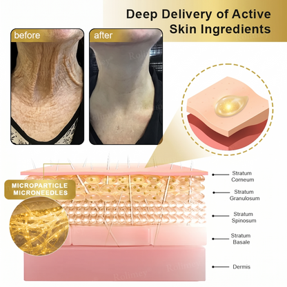 💫Rolimey® Collagen Fullerene Cream, Rolimey Collagen Cream with Collagen Peptides, 2026 New Tighten & Lift Cream for Crepey Skin, Wrinkles and Tightening for Skin Types